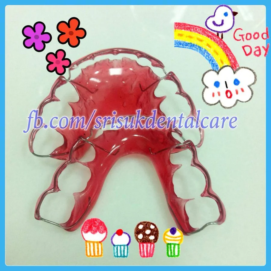 รีเทนเนอร์ 7