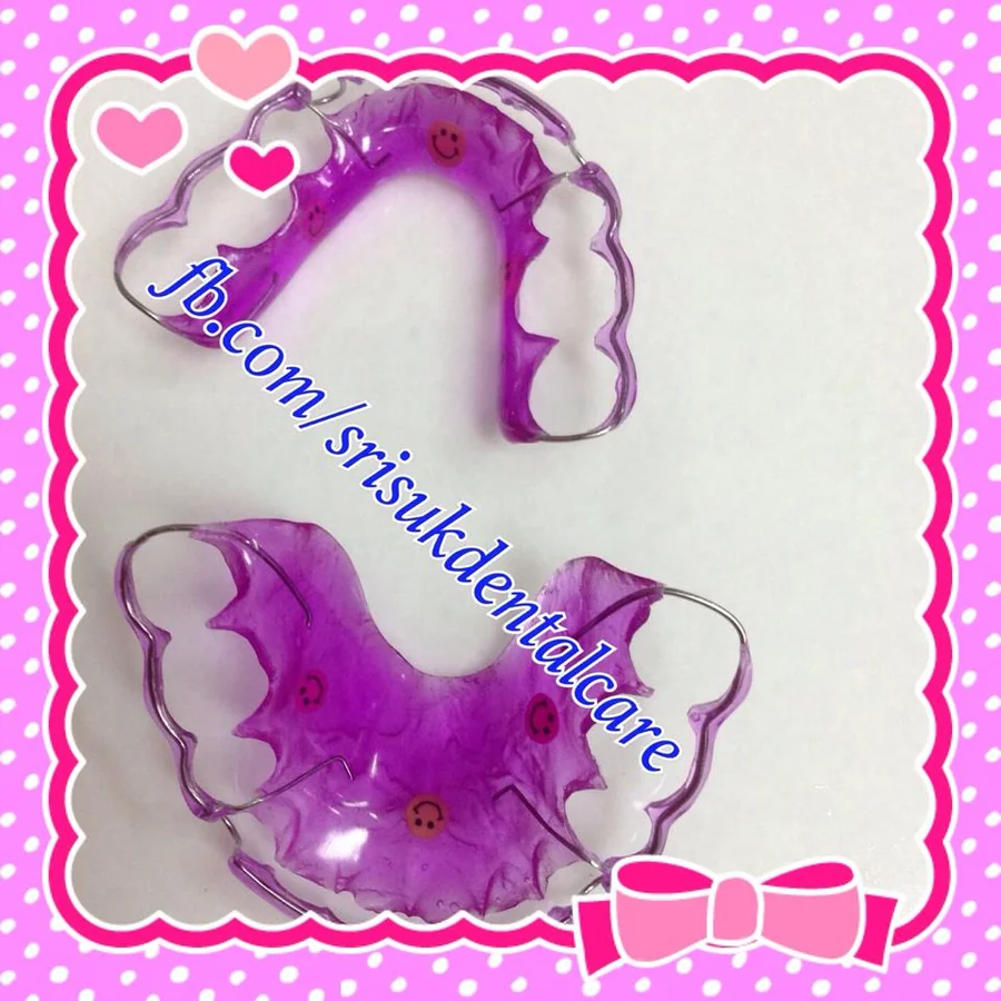 รีเทนเนอร์ 8