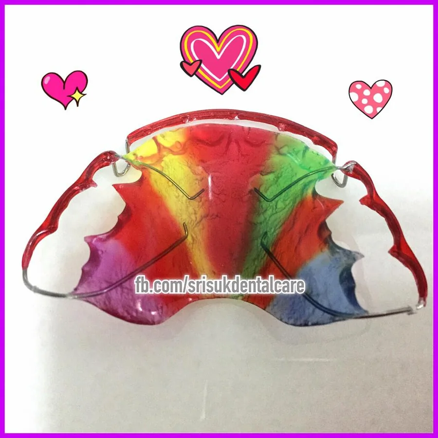 รีเทนเนอร์ 9