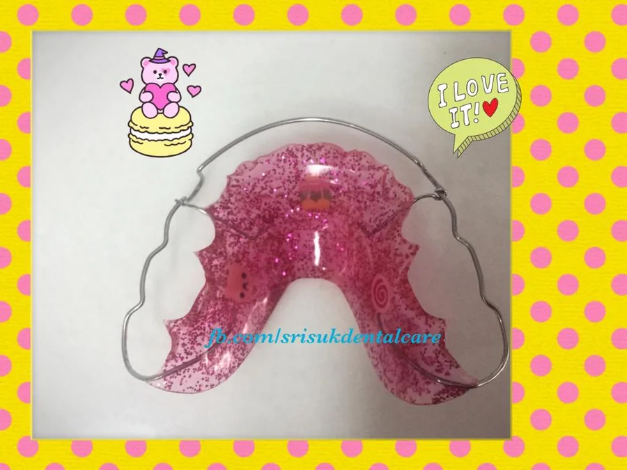 รีเทนเนอร์ 10