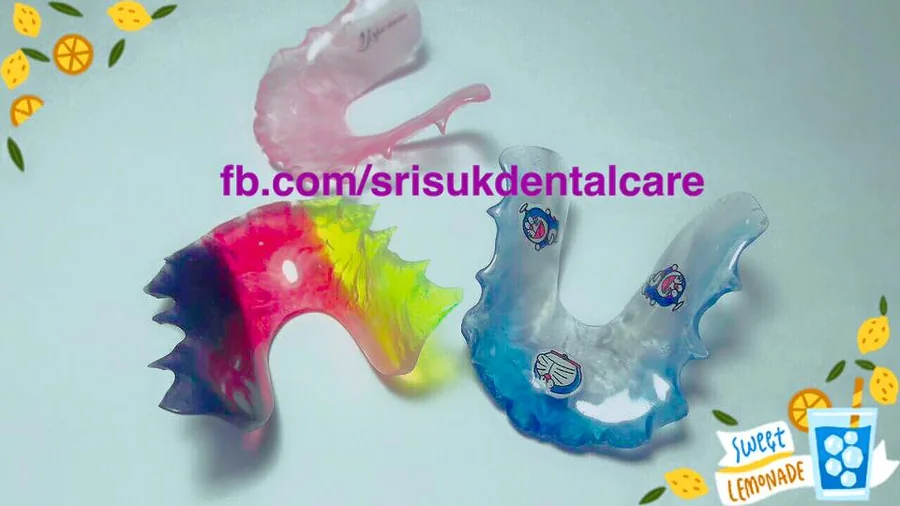 รีเทนเนอร์ 14